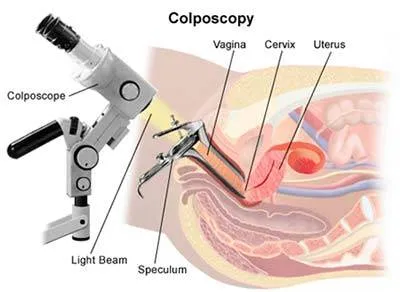 Pap Smear and Colposcopy Specialist in Andheri West,Mumbai image 1